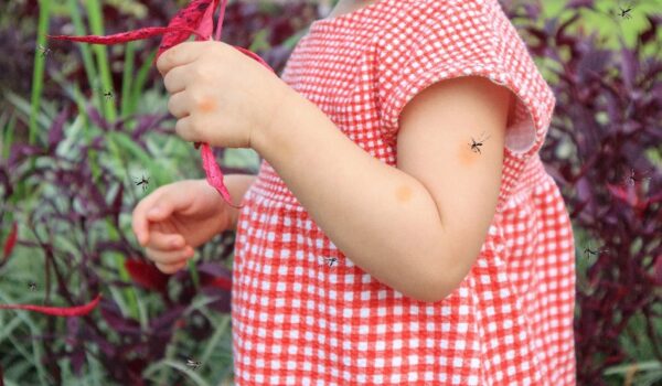 Zanzare, zecche, vespe, api, calabroni e ragni: il vademecum del pediatra