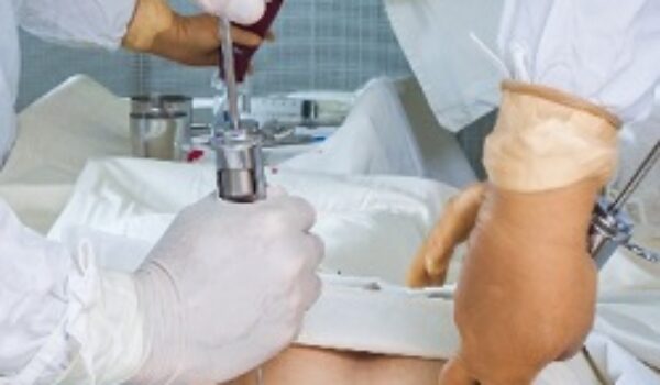 Mezzo milione di donatori di midollo osseo in Italia, è record