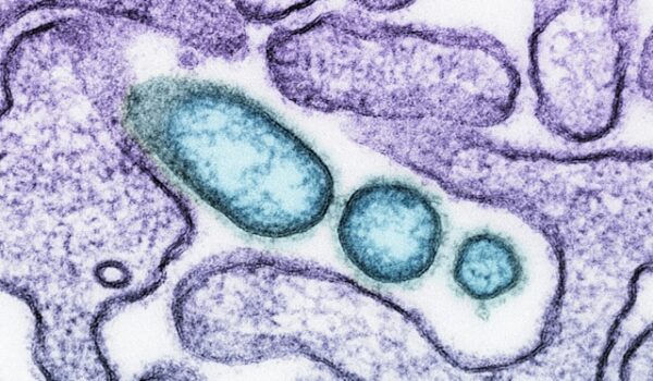 Infezioni sessualmente trasmesse. Aumentano tra i giovani, nonostante il 60% si consideri informato
