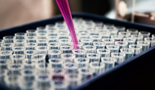 “Effetti del trattamento con analogo dell’ormone rilasciante gonadotropine sulle bambine affette da pubertà precoce centrale e anticipata” sulla RIMA, Rivista Italiana di Medicina dell’Adolescenza, Vol. 22 – n. 3 – 2024