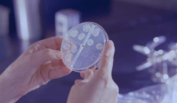 Più casi di tubercolosi in Europa, 1 su 20 ha meno di 15 anni